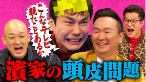 かまいガチ 濱家の薄毛がやばい！！各局に配る「頭皮の取扱説明書」を作れ！（2026/02/04放送分）